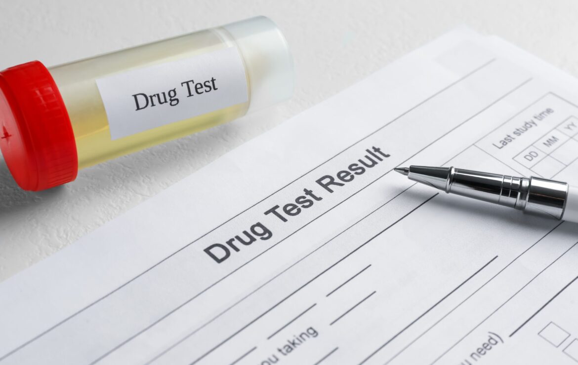 Do CDPAP PCAs get Drug tested in New York?